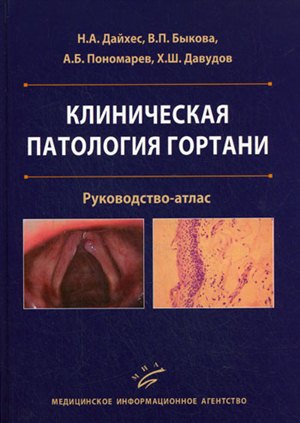 Как накачать мышцы ягодиц