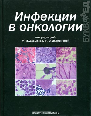 Как научиться подтягиваться 20 раз