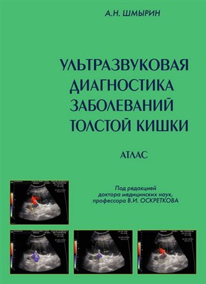 Как накачать мышцы плеч