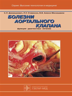 Тренировка ног бодибилдинг