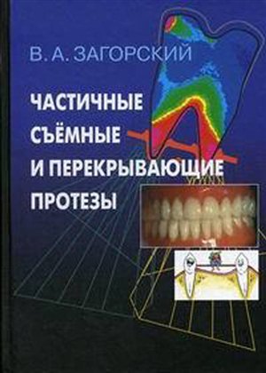 Как накачать ягодицы